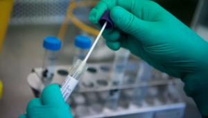 Mời cung cấp báo giá: Mua sinh phẩm Invitro